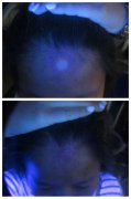 <b>远离白斑 做美丽女人</b>